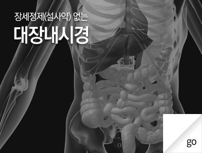 대장내시경